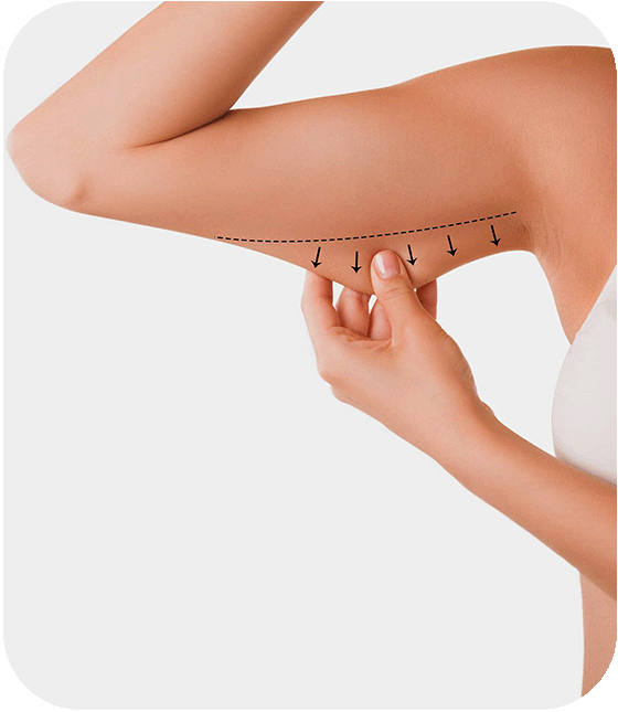 arm lift surgery turkey