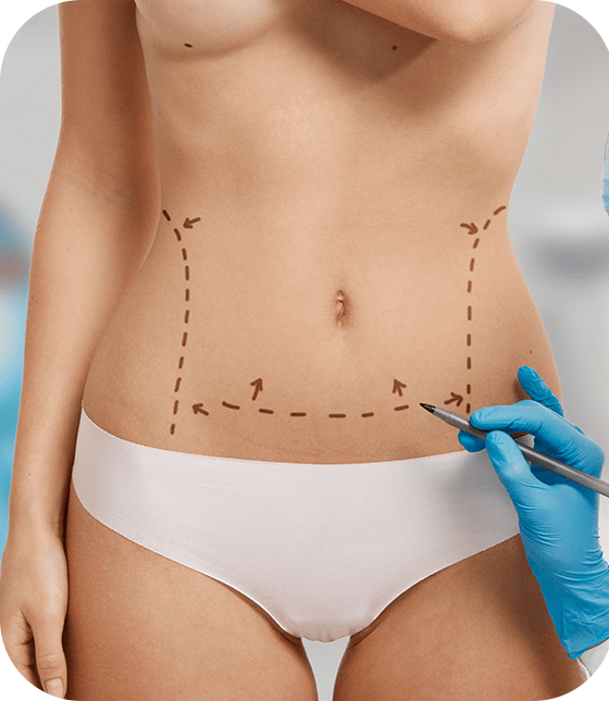 abdominoplasty surgery turkey